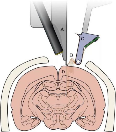 �������ű����������ѧ������˹�˵��Ի��ӿڹ�˾Neuralink�и�����ɢ������