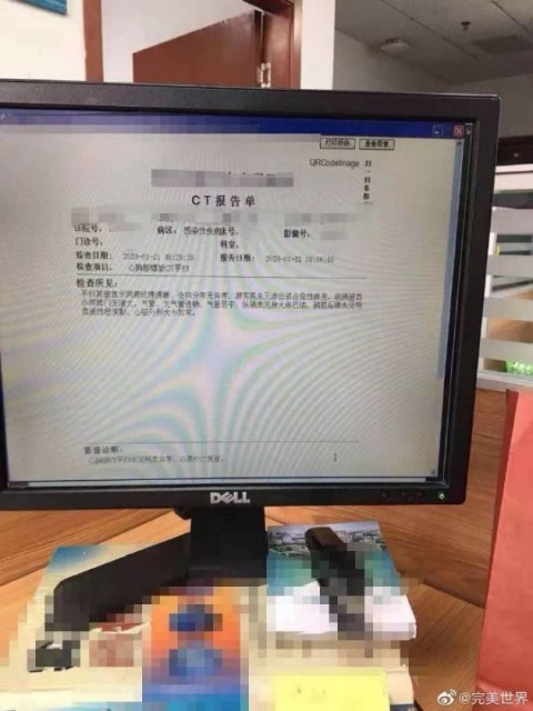 QQͼƬ20200121145258
